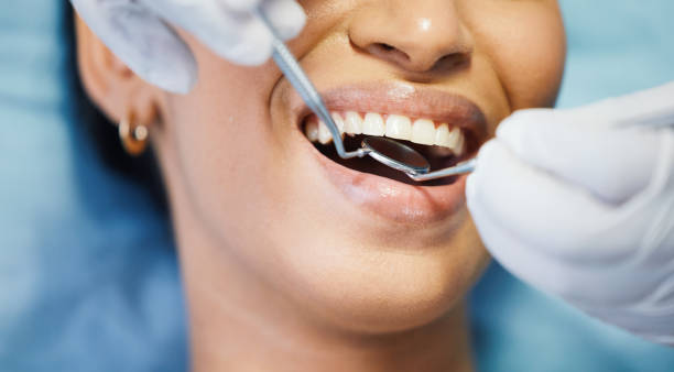 Best Emergency Wisdom Tooth Extraction in Altamont, TN